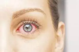Uveíte Vítrea Clínica de Olhos Guarapari Oftalmologista